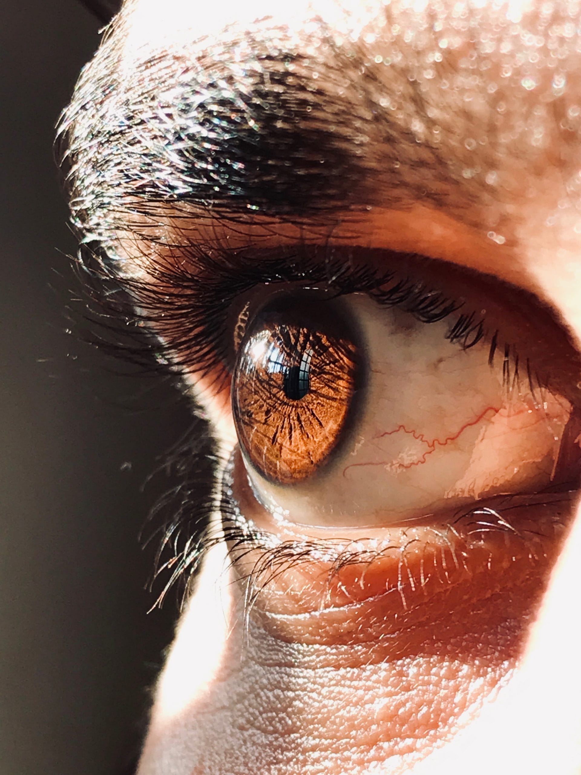 Adaptation de lentilles de contact en Savoie