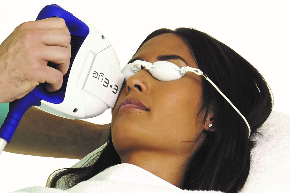 Traitement par lumière pulsée intense IPL